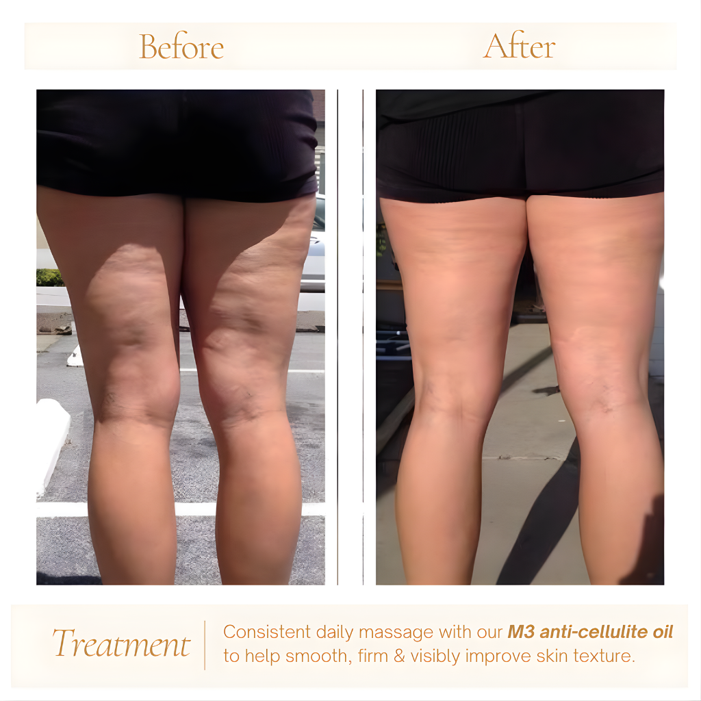 M3 Anti-Cellulite Massage Oil Infused with Collagen + Stem Cell