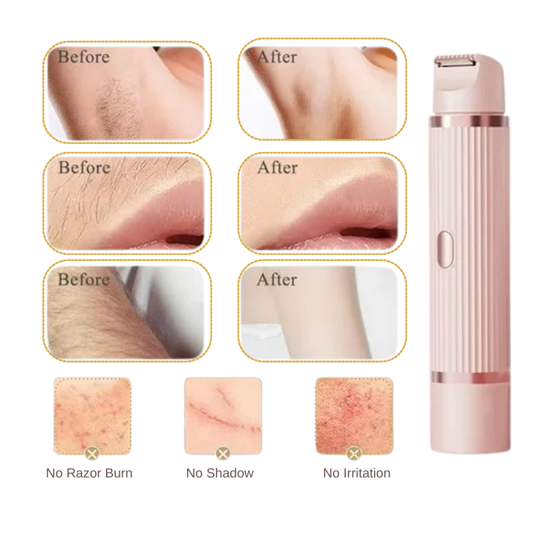 BareBelle™  -  Dual Head Hair Remover